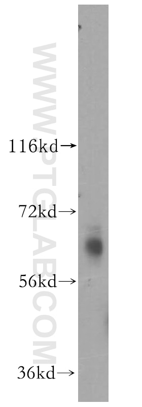 Western Blot (WB) analysis of HeLa cells using GABRD Polyclonal antibody (15623-1-AP)