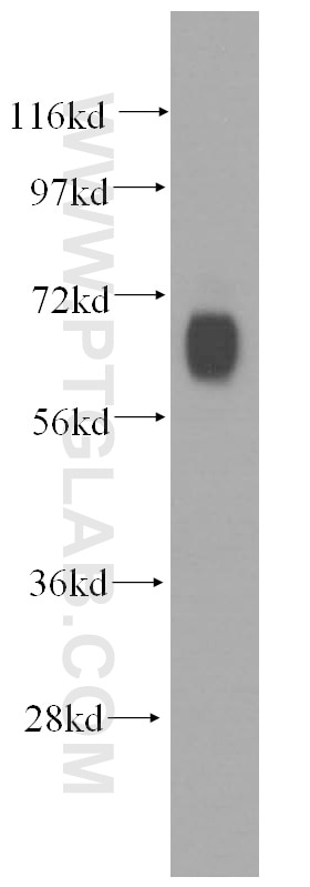 Western Blot (WB) analysis of human brain tissue using GABRD Polyclonal antibody (15623-1-AP)