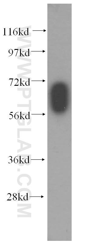 Western Blot (WB) analysis of human kidney tissue using GABRD Polyclonal antibody (15623-1-AP)