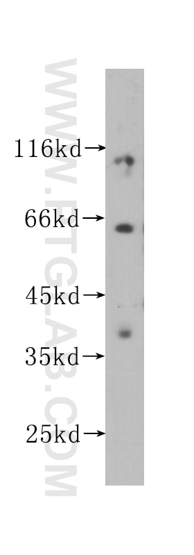 Western Blot (WB) analysis of HepG2 cells using GABRD Monoclonal antibody (60163-1-Ig)