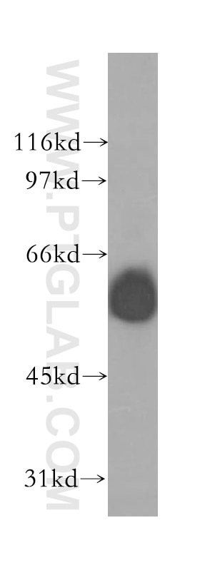 Western Blot (WB) analysis of mouse eye tissue using GABRG1 Polyclonal antibody (12871-1-AP)