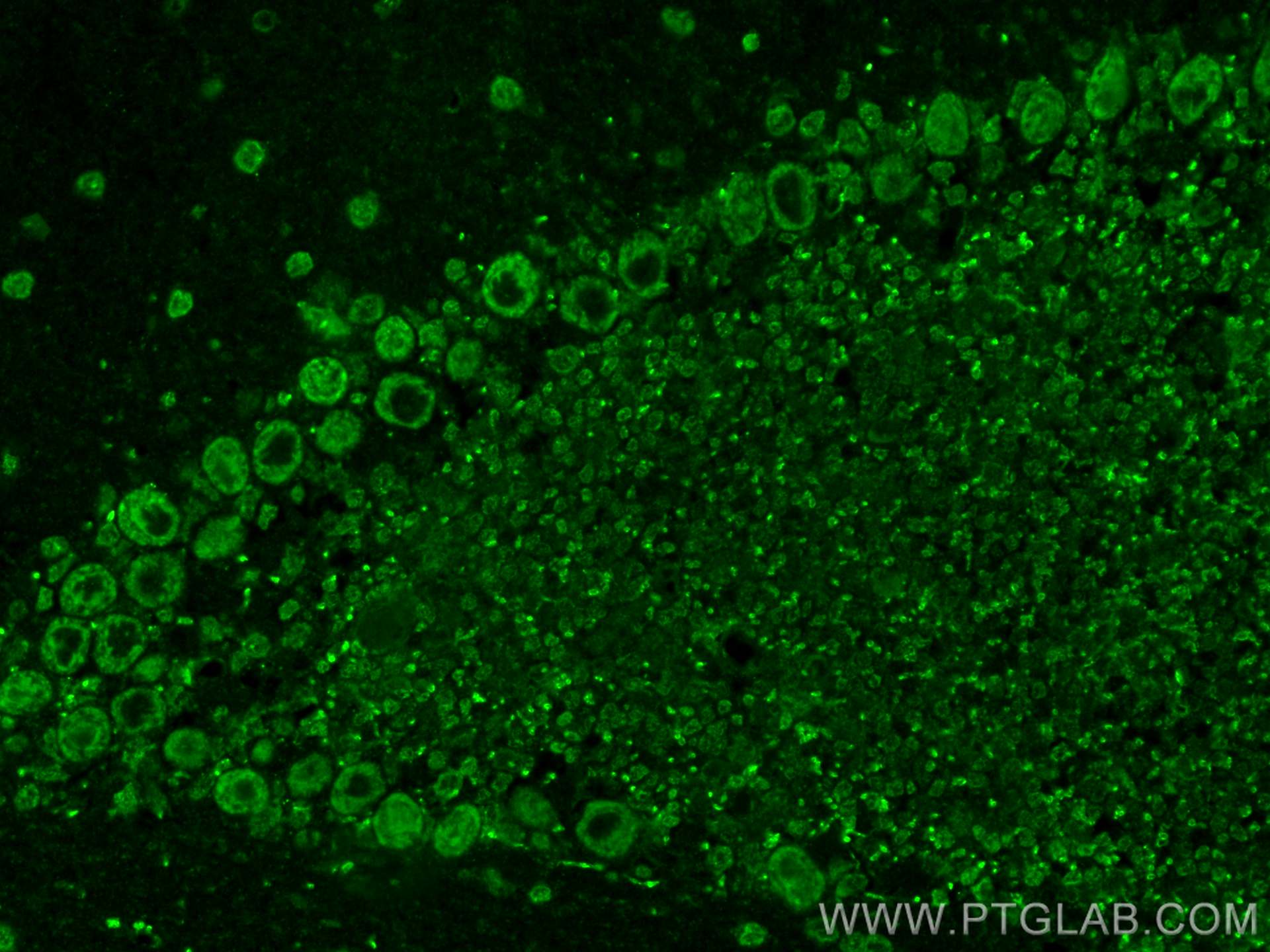 Immunofluorescence (IF) / fluorescent staining of mouse cerebellum tissue using GABRG2 Polyclonal antibody (14104-1-AP)