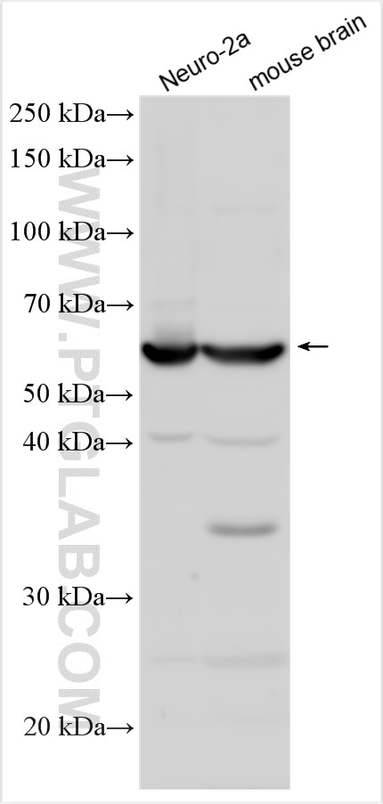 Western Blot (WB) analysis of various lysates using GABRG2 Polyclonal antibody (14104-1-AP)
