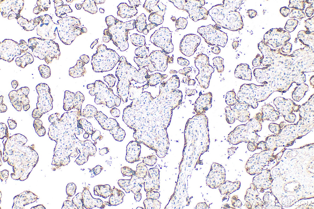 Immunohistochemistry (IHC) staining of human placenta tissue using GABRP Polyclonal antibody (30642-1-AP)