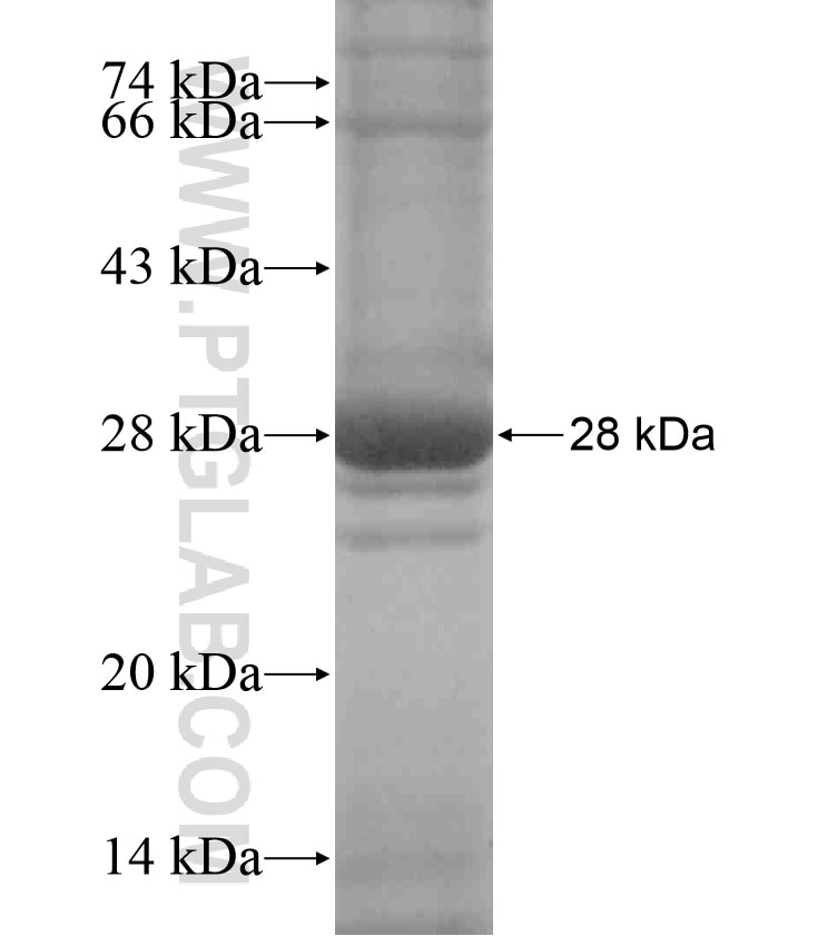 GABRQ fusion protein Ag17985 SDS-PAGE