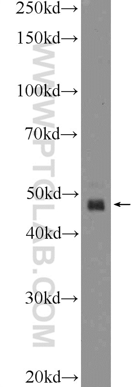 Western Blot (WB) analysis of mouse skeletal muscle tissue using GABRR1 Polyclonal antibody (25899-1-AP)