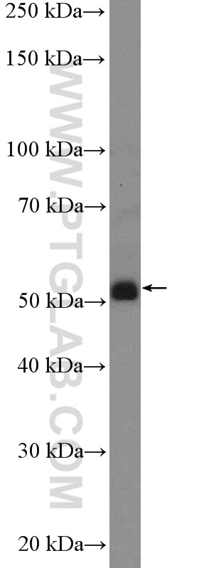 Western Blot (WB) analysis of mouse brain tissue using GABRR1 Polyclonal antibody (25899-1-AP)