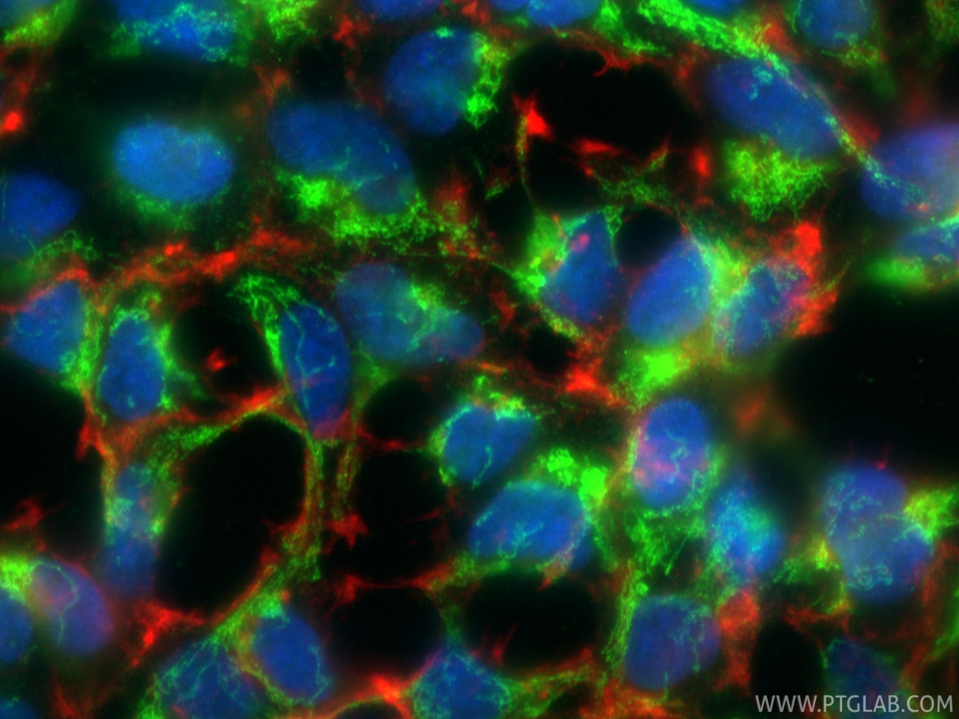 IF Staining of HEK-293 using 19958-1-AP Immunofluorescence (IF) / fluorescent staining of HEK-293 cells using GAC-specific Polyclonal antibody (19958-1-AP)