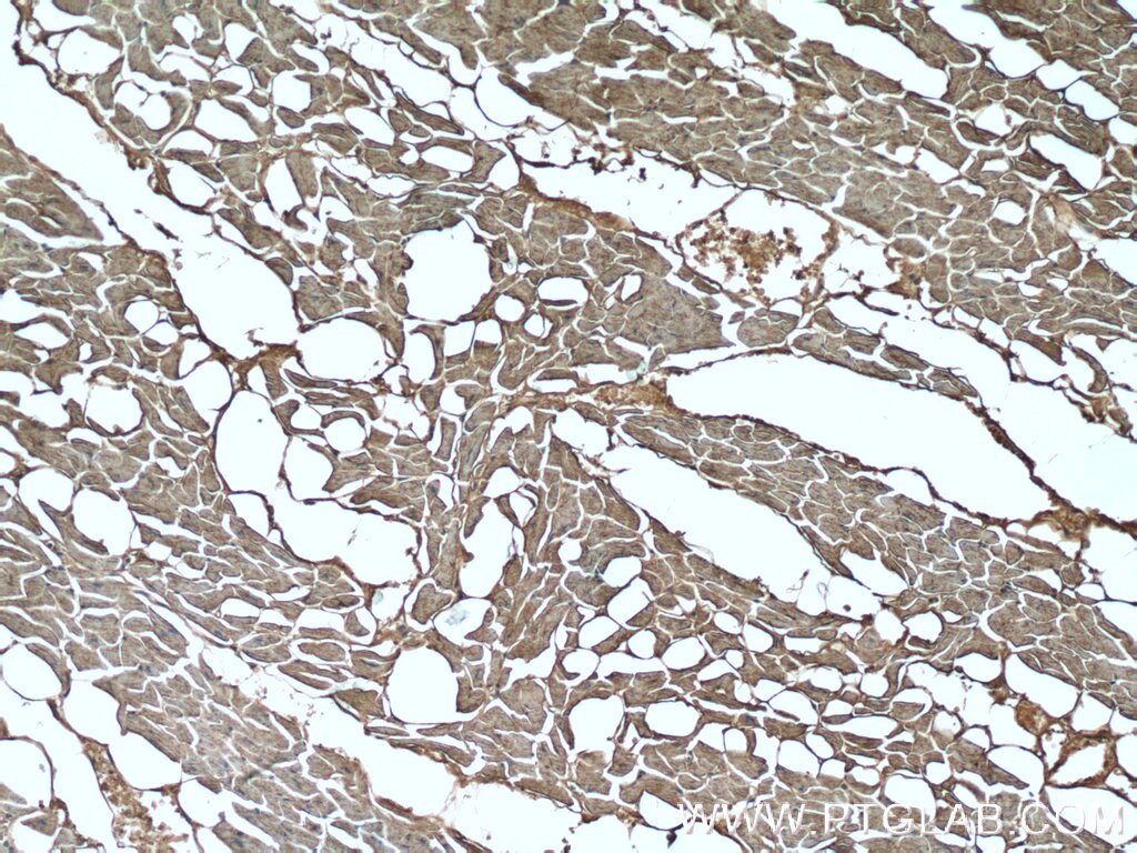 Immunohistochemistry (IHC) staining of human heart tissue using GAC-specific Polyclonal antibody (19958-1-AP)