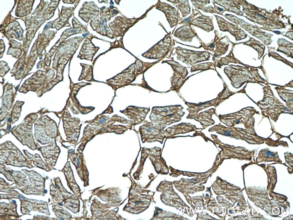 Immunohistochemistry (IHC) staining of human heart tissue using GAC-specific Polyclonal antibody (19958-1-AP)