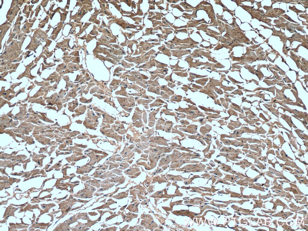 Immunohistochemistry (IHC) staining of human heart tissue using GAC-specific Polyclonal antibody (19958-1-AP)