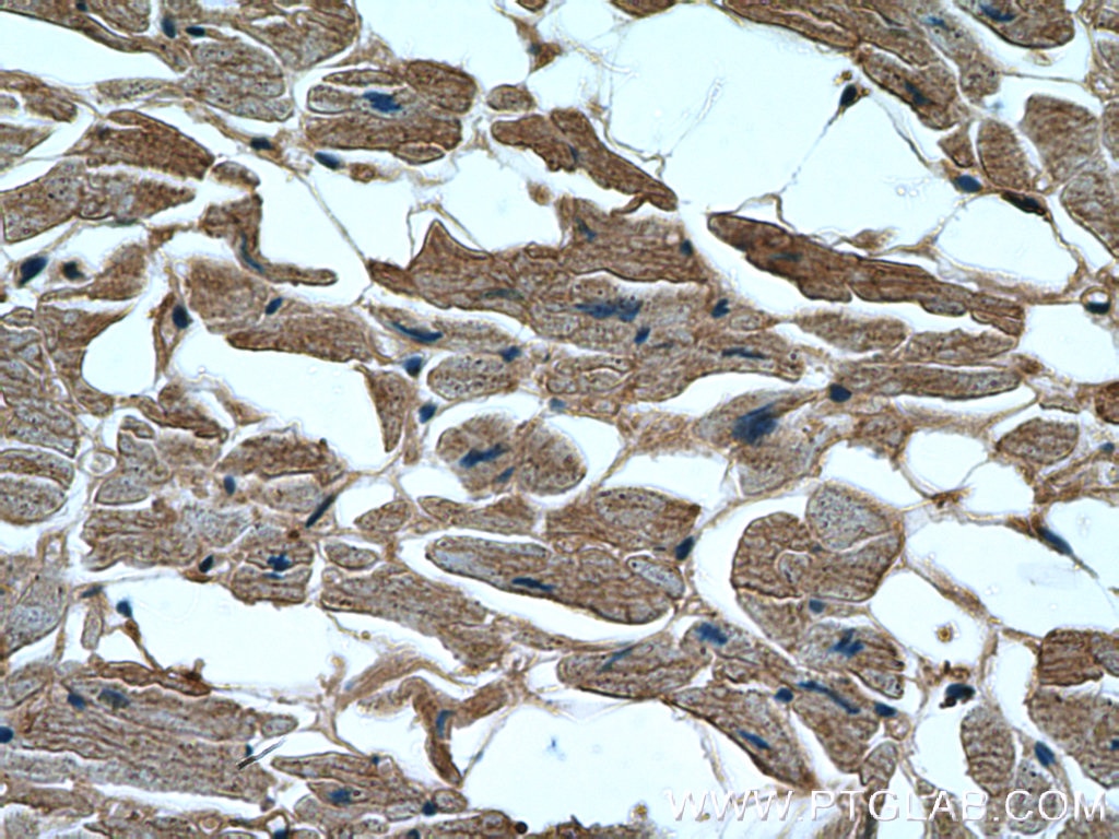 Immunohistochemistry (IHC) staining of human heart tissue using GAC-specific Polyclonal antibody (19958-1-AP)