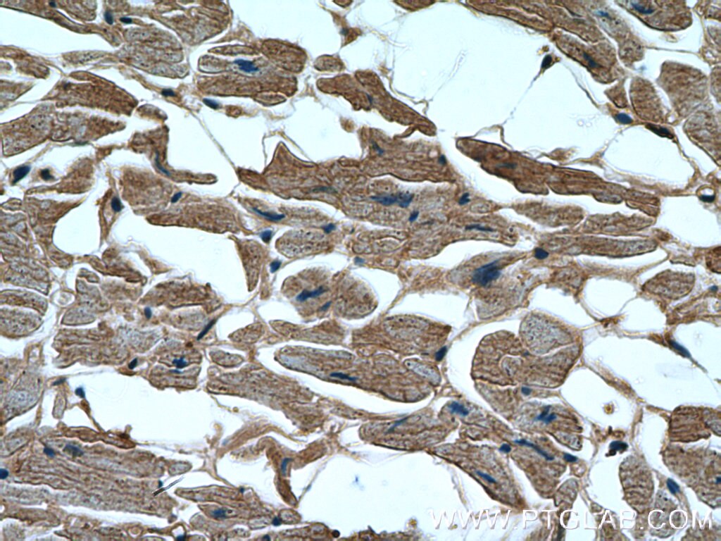 Immunohistochemistry (IHC) staining of human heart tissue using GAC-specific Polyclonal antibody (19958-1-AP)