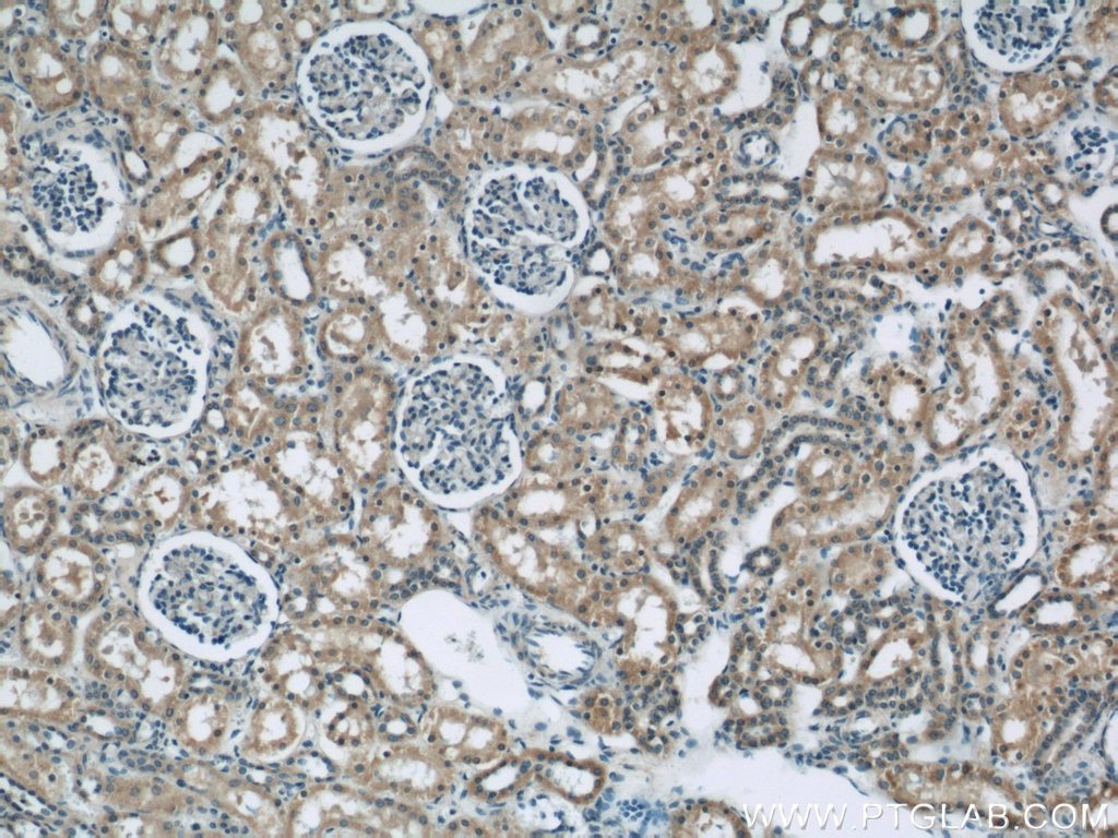 Immunohistochemistry (IHC) staining of human kidney tissue using GAC-specific Polyclonal antibody (19958-1-AP)