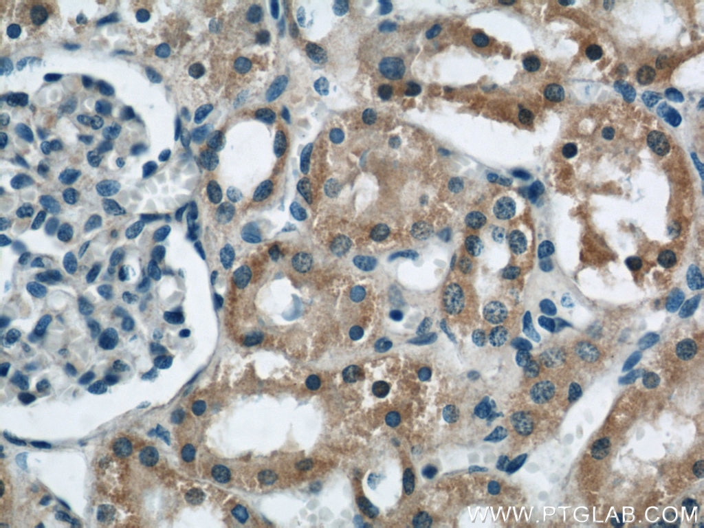 Immunohistochemistry (IHC) staining of human kidney tissue using GAC-specific Polyclonal antibody (19958-1-AP)