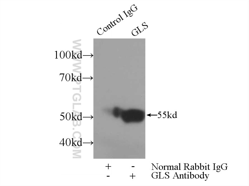 Immunoprecipitation (IP) experiment of mouse kidney tissue using GAC-specific Polyclonal antibody (19958-1-AP)