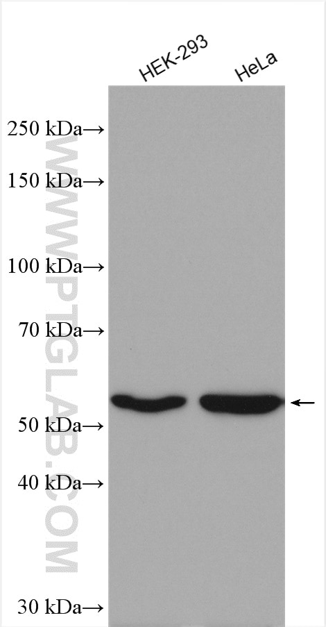 Western Blot (WB) analysis of various lysates using GAC-specific Polyclonal antibody (19958-1-AP)