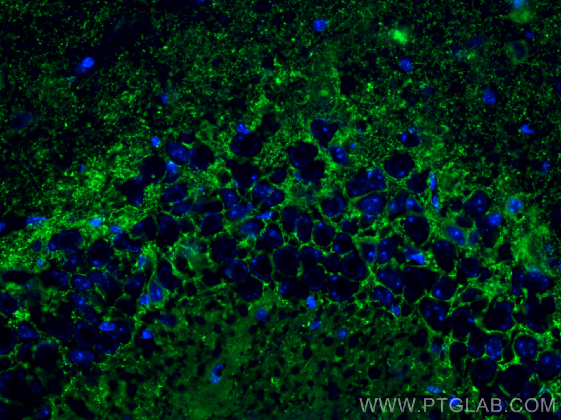 Immunofluorescence (IF) / fluorescent staining of mouse brain tissue using GAD1 Polyclonal antibody (10408-1-AP)