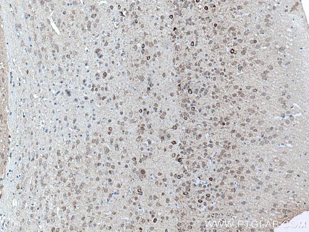 Immunohistochemistry (IHC) staining of mouse brain tissue using GAD1 Polyclonal antibody (10408-1-AP)