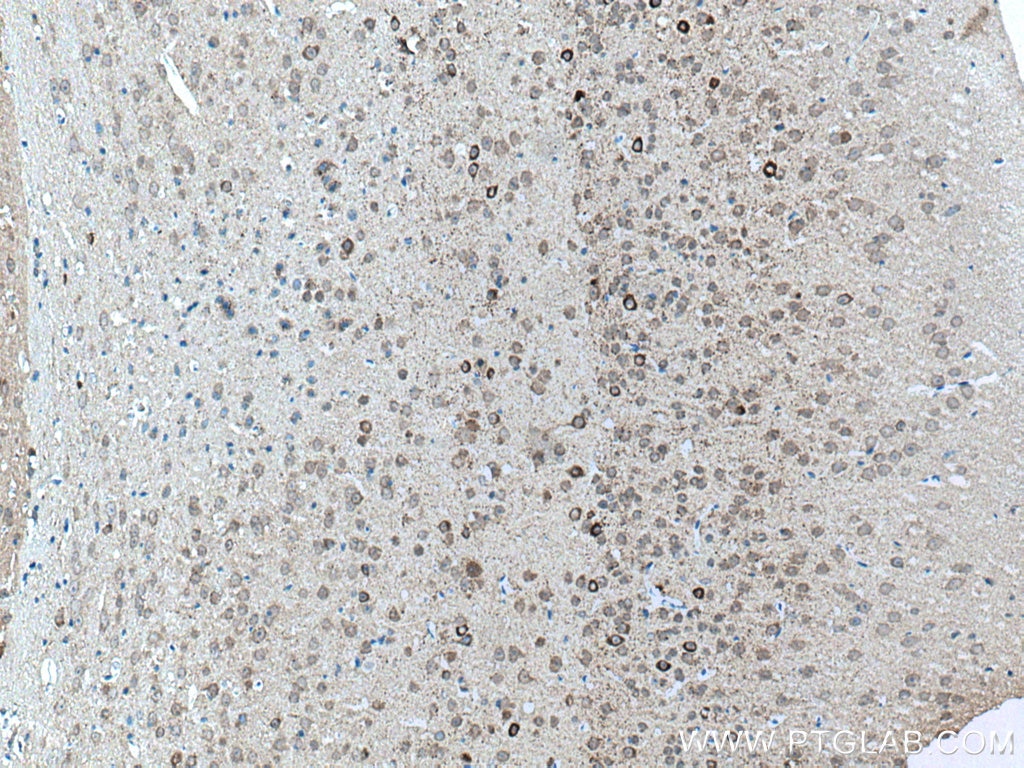 IHC staining of mouse brain using 10408-1-AP