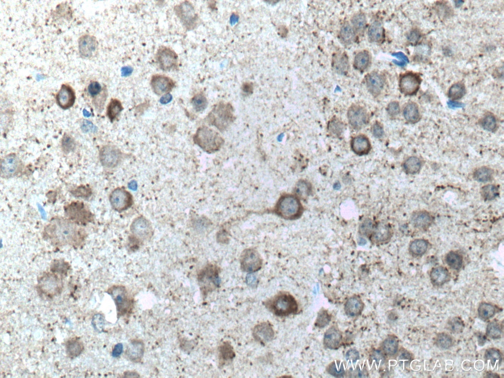 Immunohistochemistry (IHC) staining of mouse brain tissue using GAD1 Polyclonal antibody (10408-1-AP)