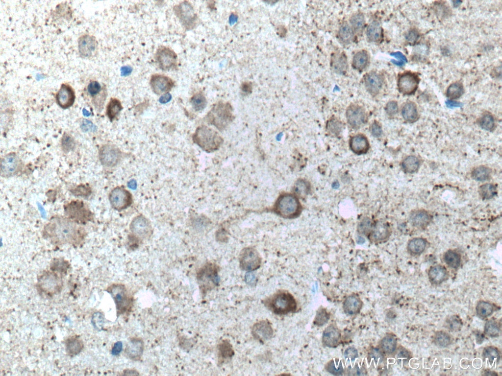 IHC staining of mouse brain using 10408-1-AP