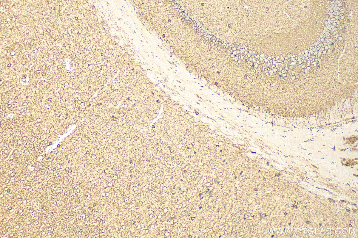 Immunohistochemistry (IHC) staining of mouse brain tissue using GAD1 Polyclonal antibody (10408-1-AP)