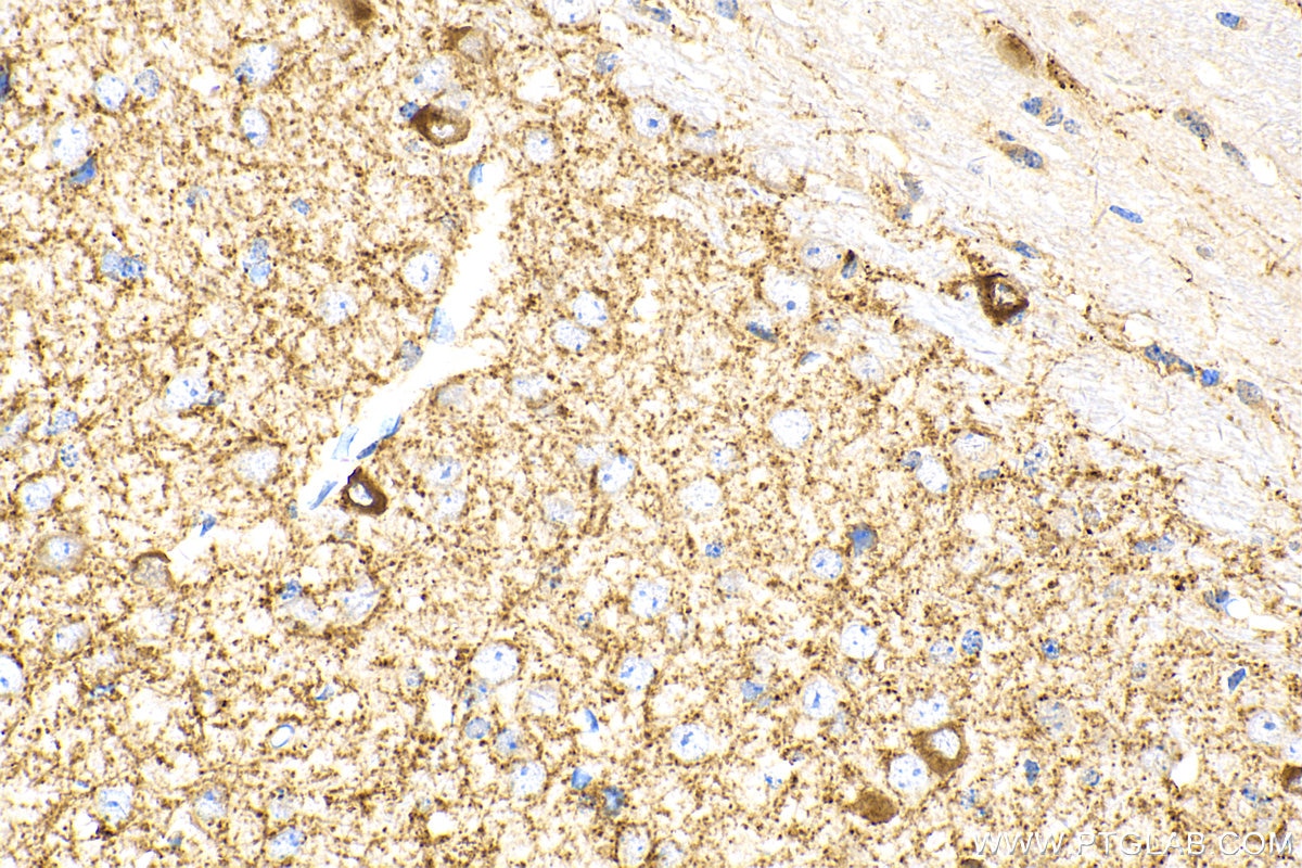 IHC staining of mouse brain using 10408-1-AP