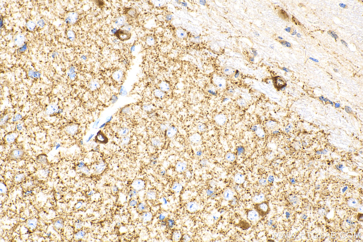 Immunohistochemistry (IHC) staining of mouse brain tissue using GAD1 Polyclonal antibody (10408-1-AP)