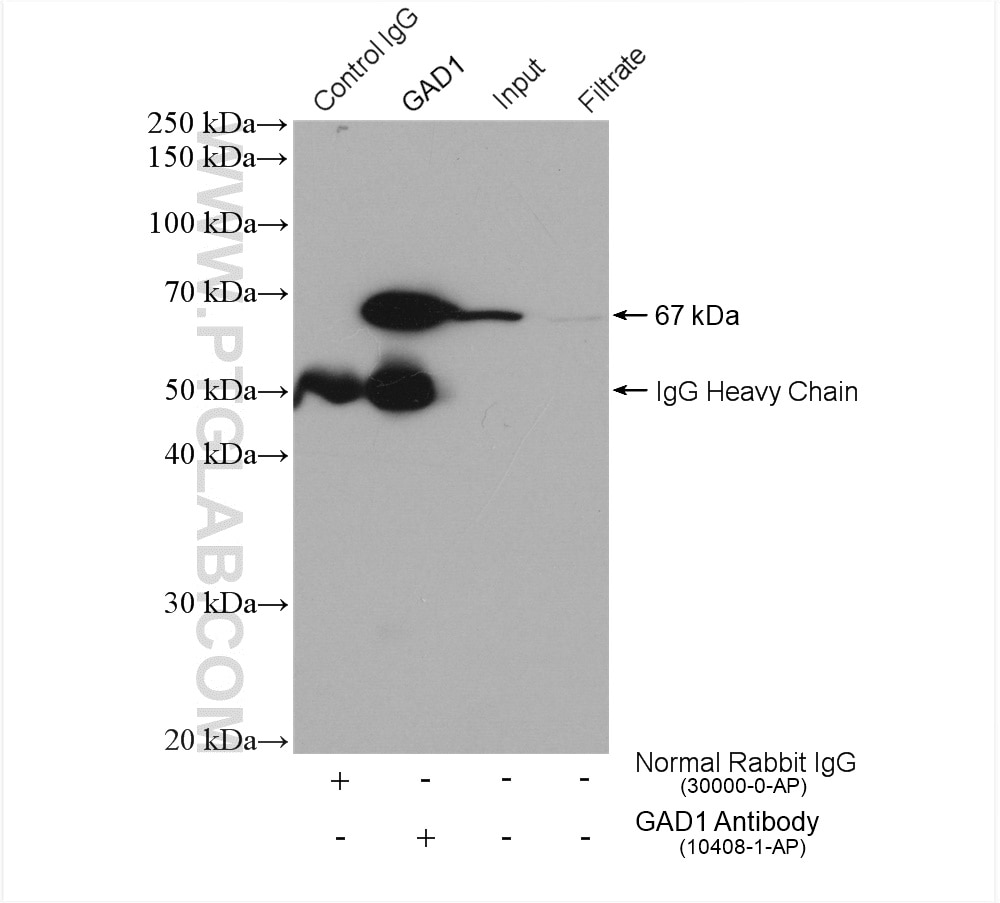 Immunoprecipitation (IP) experiment of mouse brain tissue using GAD1 Polyclonal antibody (10408-1-AP)