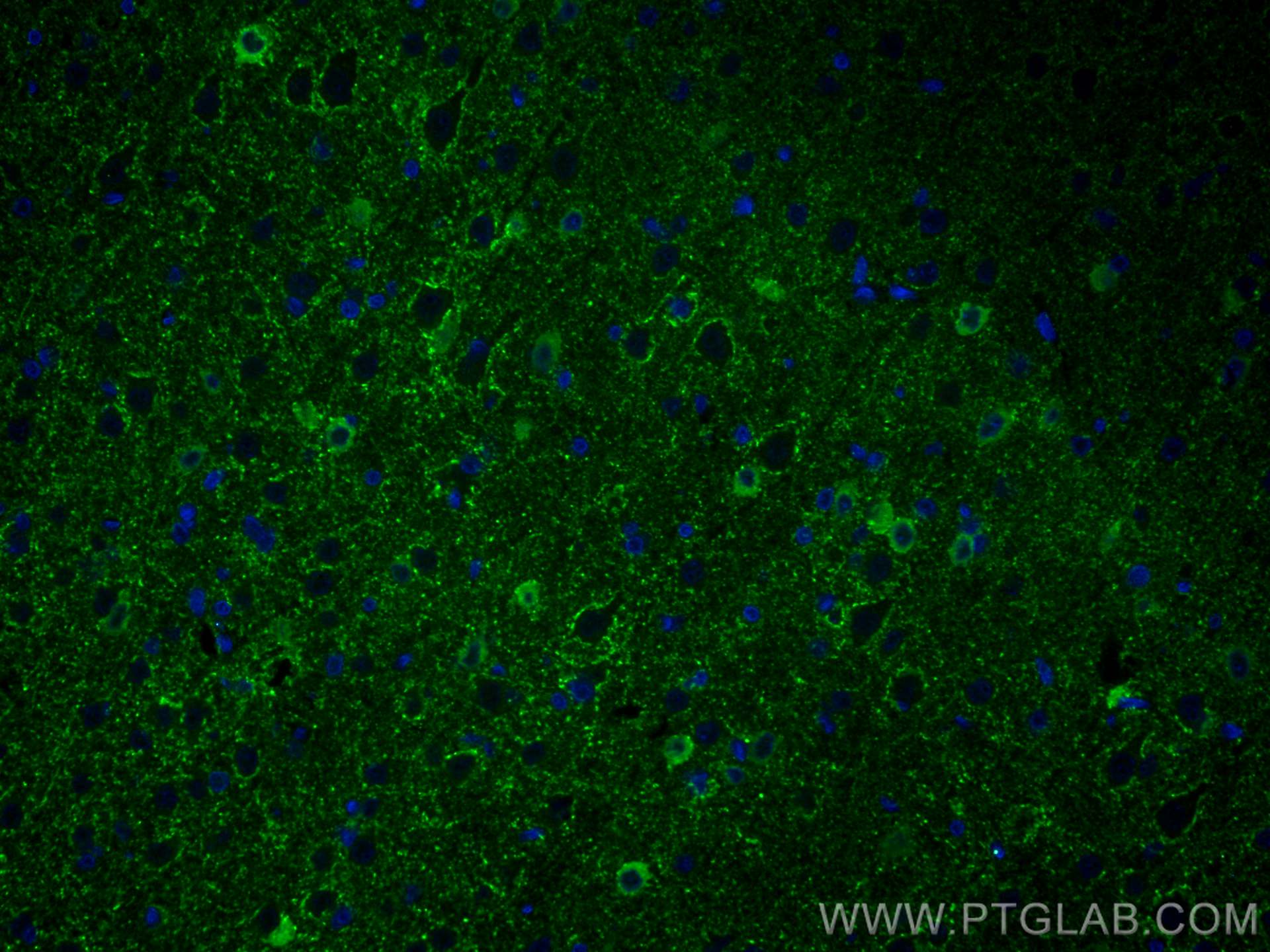 Immunofluorescence (IF) / fluorescent staining of rat brain tissue using GAD1 Monoclonal antibody (67648-1-Ig)