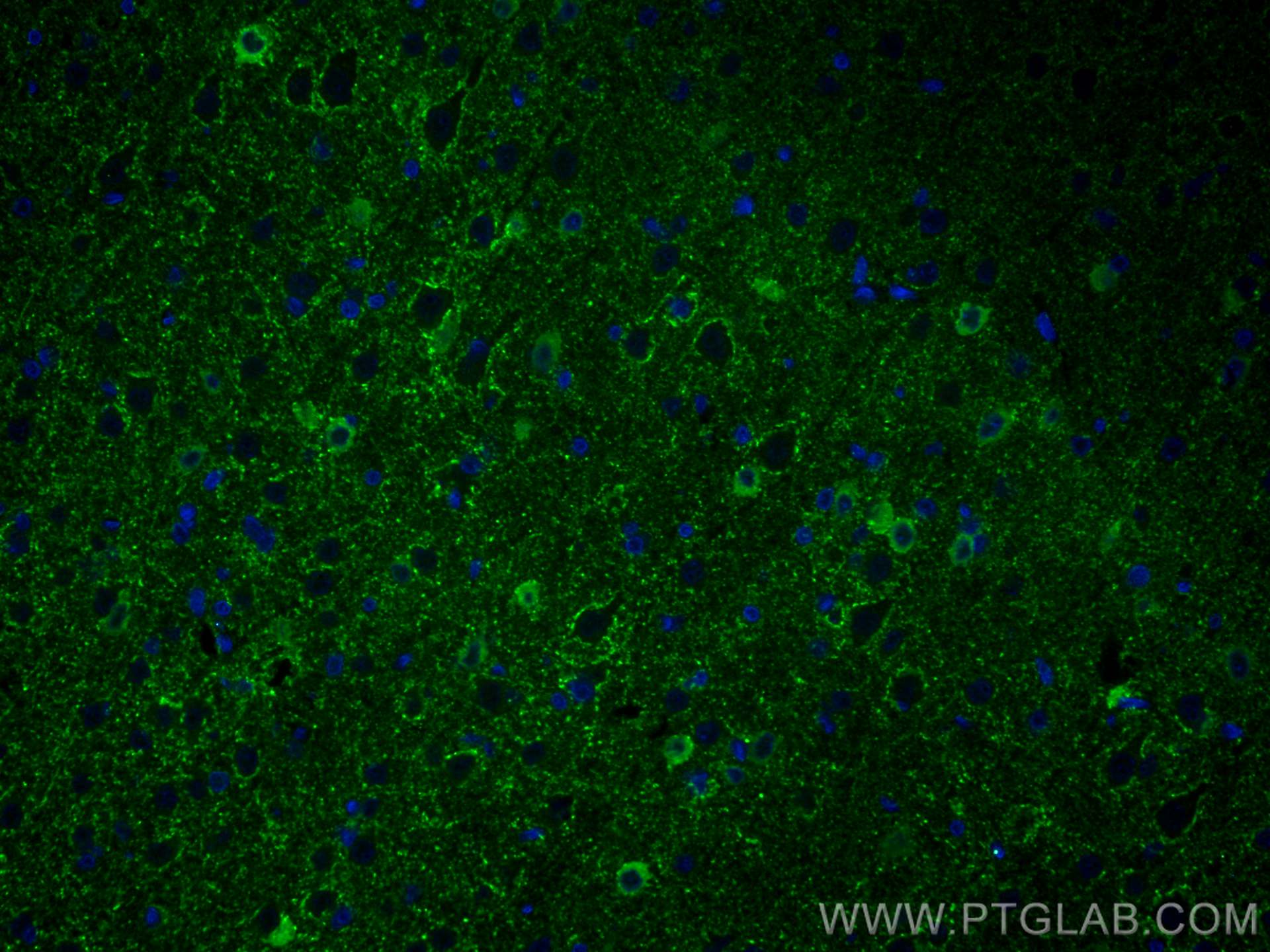 IF Staining of rat brain using 67648-1-Ig