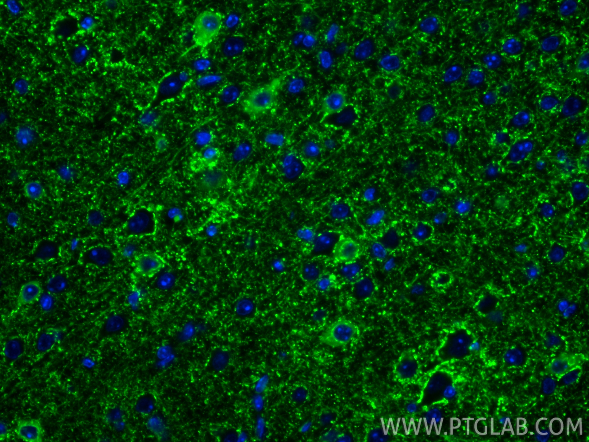 IF Staining of mouse brain using 67648-1-Ig (same clone as 67648-1-PBS) Immunofluorescence (IF) / fluorescent staining of mouse brain tissue using GAD1 Monoclonal antibody (67648-1-Ig)