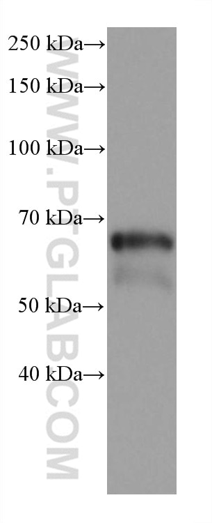 Western Blot (WB) analysis of rat brain tissue using GAD1 Monoclonal antibody (67648-1-Ig)