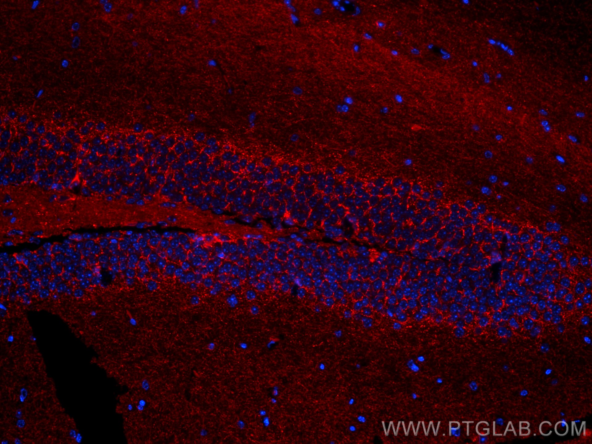 Immunofluorescence (IF) / fluorescent staining of mouse brain tissue using CoraLite®594-conjugated GAD1 Monoclonal antibody (CL594-67648)
