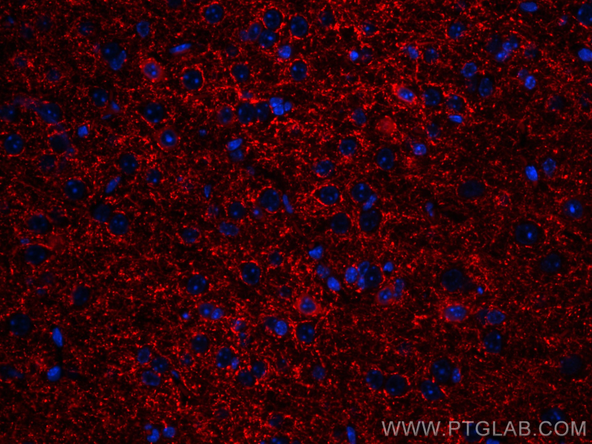 Immunofluorescence (IF) / fluorescent staining of mouse brain tissue using CoraLite®594-conjugated GAD1 Monoclonal antibody (CL594-67648)