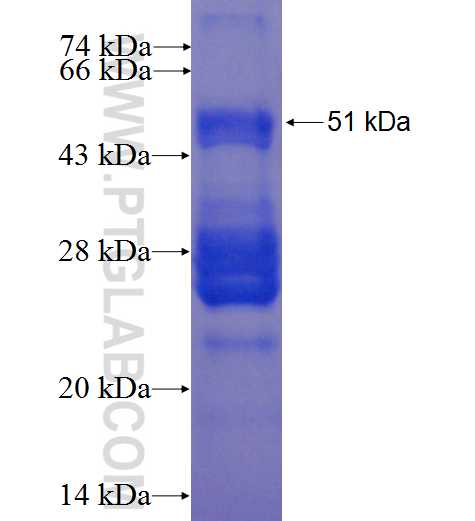 GAD1 fusion protein Ag0666 SDS-PAGE