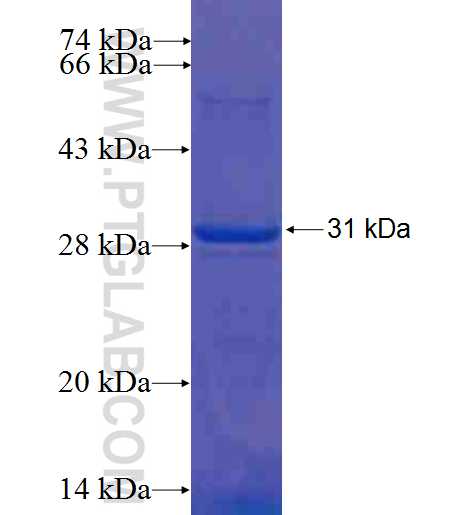 GAD1 fusion protein Ag21336 SDS-PAGE