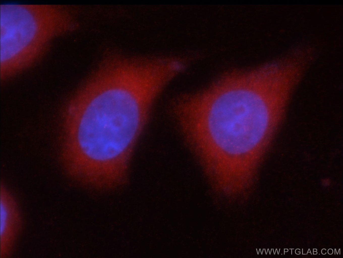 Immunofluorescence (IF) / fluorescent staining of HeLa cells using GAD65 Polyclonal antibody (20746-1-AP)