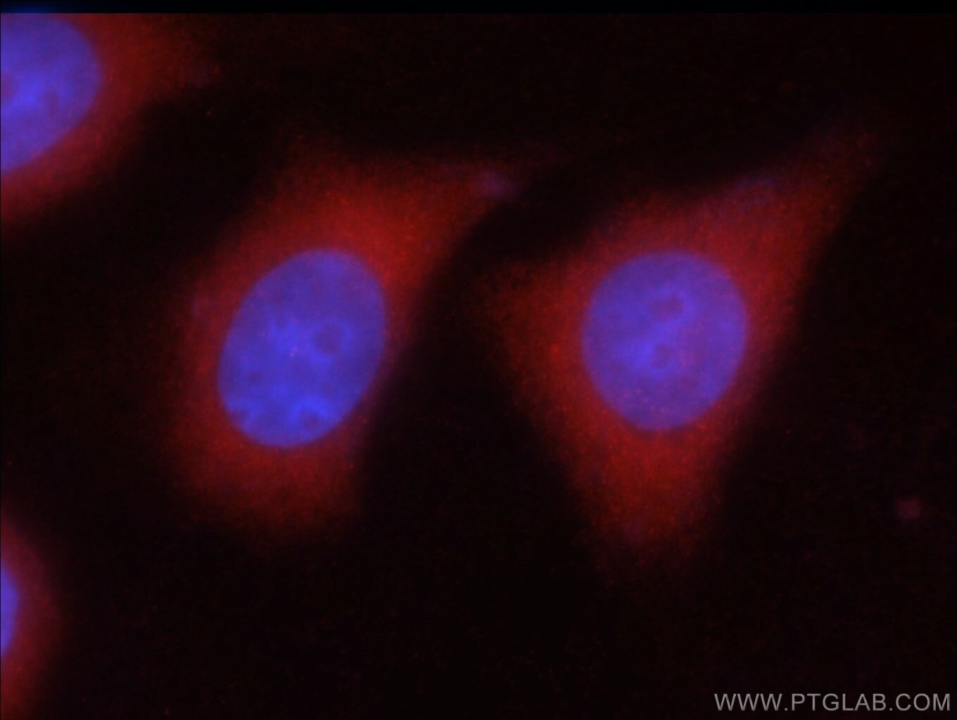 IF Staining of HeLa using 20746-1-AP