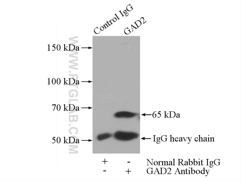 Immunoprecipitation (IP) experiment of mouse brain tissue using GAD65 Polyclonal antibody (20746-1-AP)