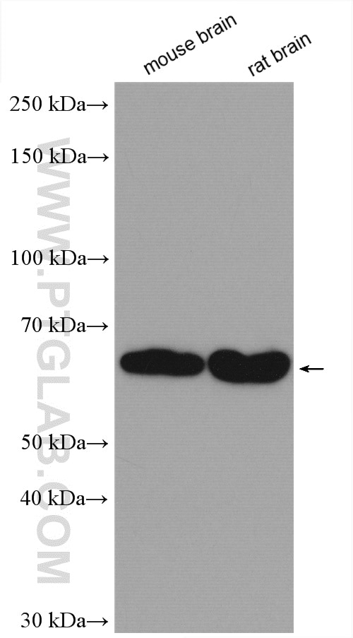 Western Blot (WB) analysis of various lysates using GAD65 Polyclonal antibody (20746-1-AP)