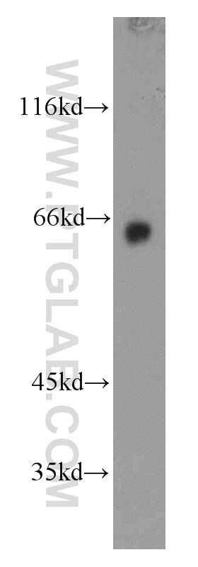 Western Blot (WB) analysis of mouse brain tissue using GAD65 Polyclonal antibody (20746-1-AP)