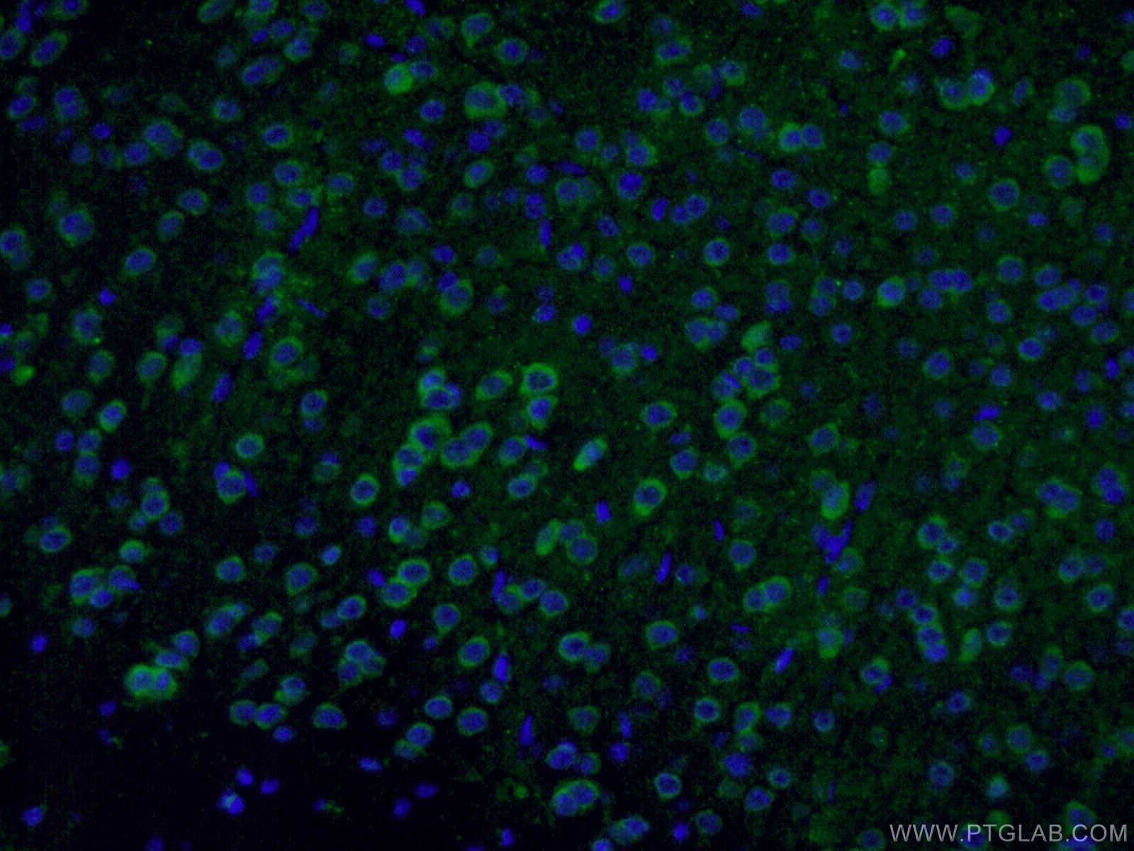 Immunofluorescence (IF) / fluorescent staining of mouse brain tissue using GAD65 Polyclonal antibody (21760-1-AP)