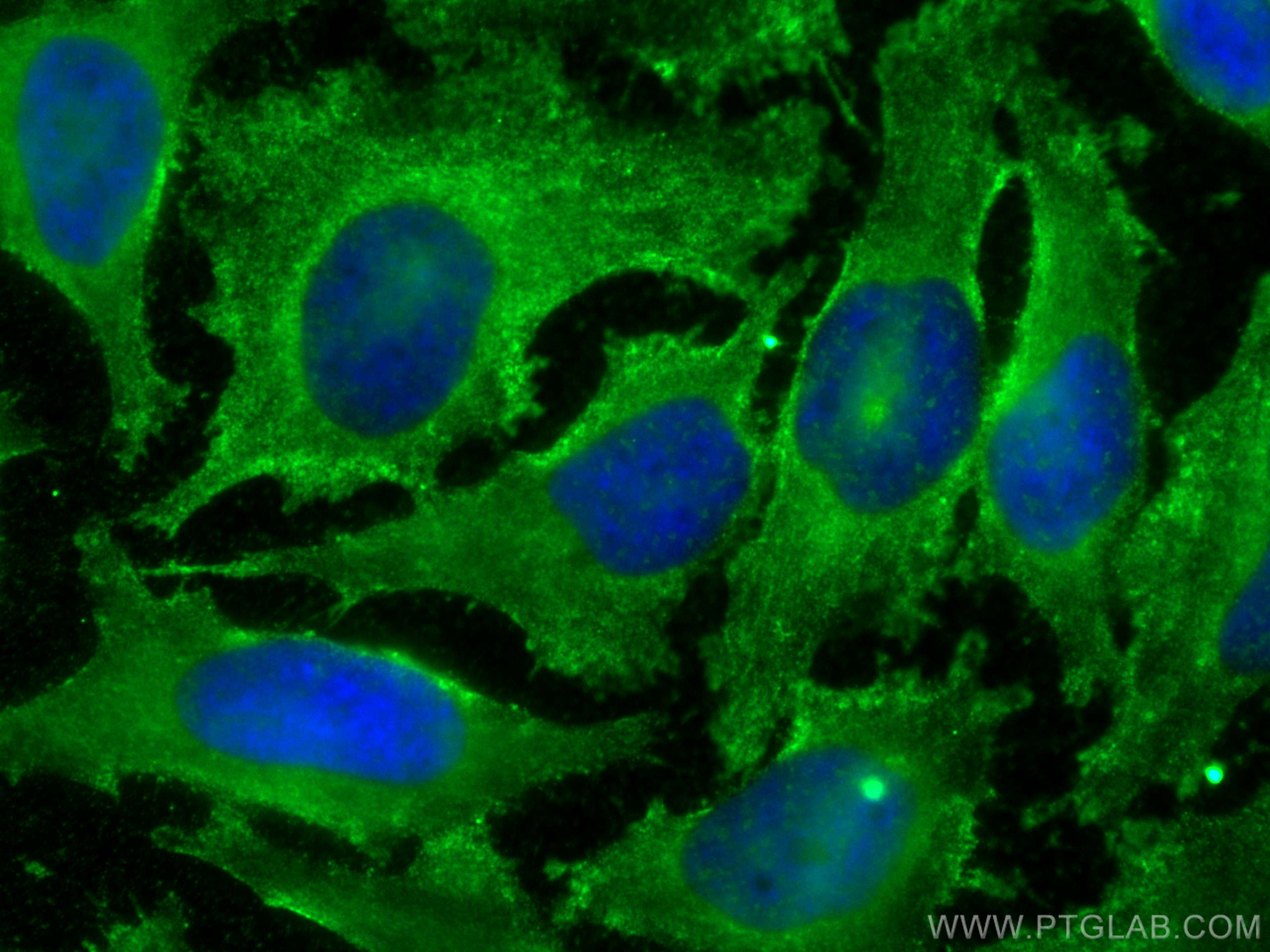 Immunofluorescence (IF) / fluorescent staining of HeLa cells using GAD65 Polyclonal antibody (21760-1-AP)
