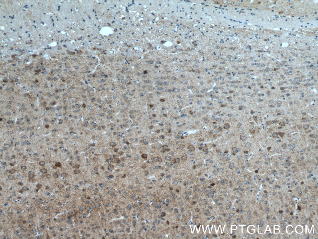 Immunohistochemistry (IHC) staining of mouse brain tissue using GAD65 Polyclonal antibody (21760-1-AP)