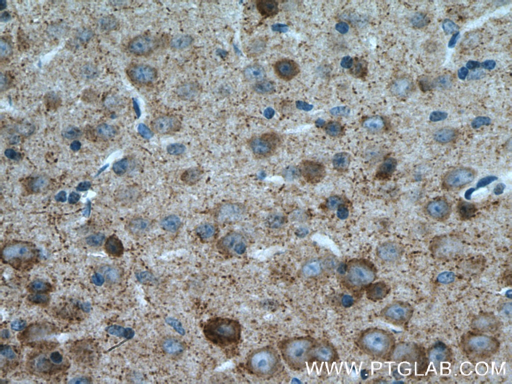 Immunohistochemistry (IHC) staining of mouse brain tissue using GAD65 Polyclonal antibody (21760-1-AP)