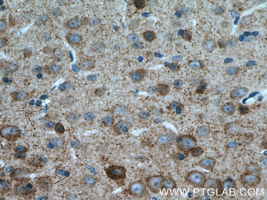 IHC staining of mouse brain using 21760-1-AP