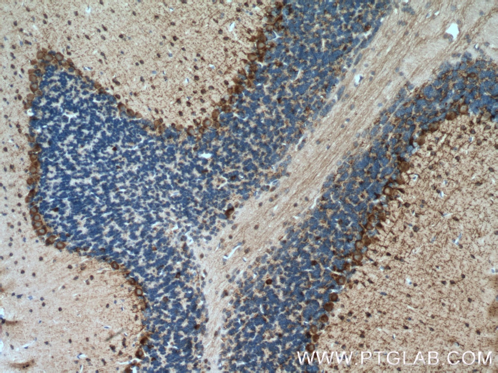 Immunohistochemistry (IHC) staining of mouse brain tissue using GAD65 Polyclonal antibody (21760-1-AP)