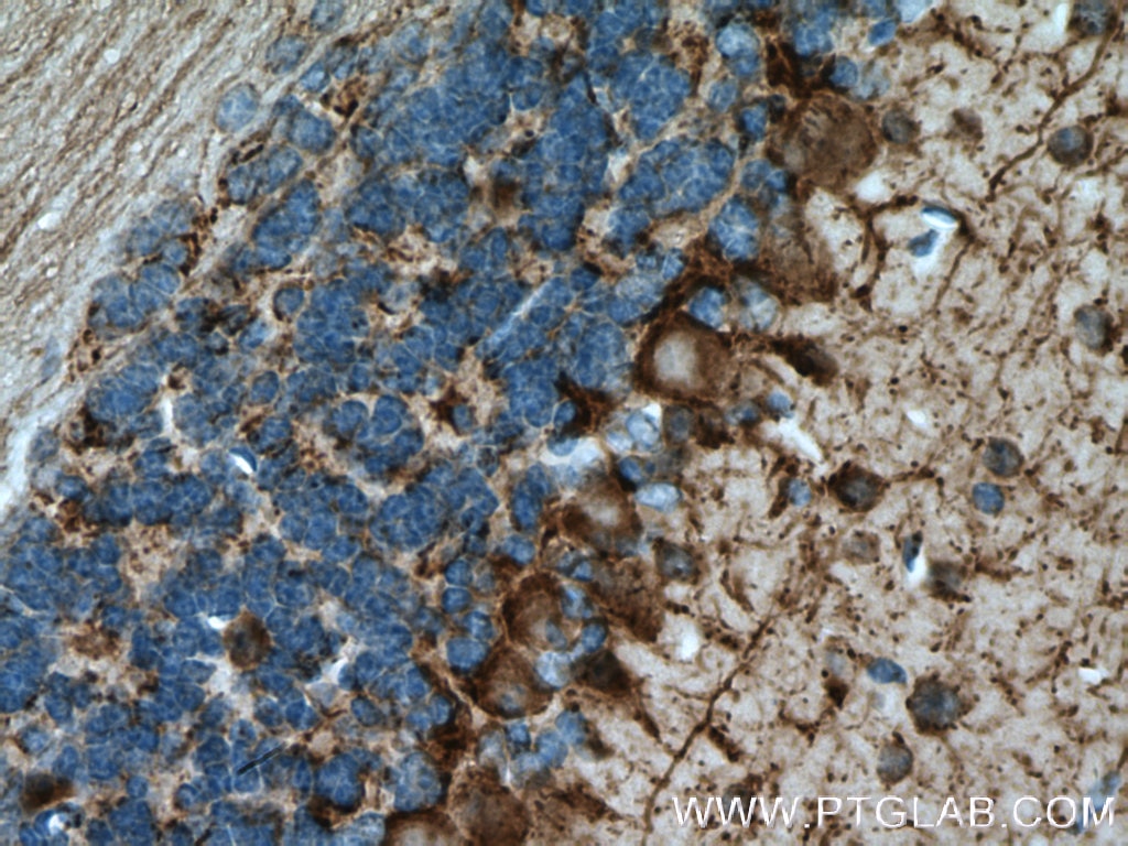 Immunohistochemistry (IHC) staining of mouse brain tissue using GAD65 Polyclonal antibody (21760-1-AP)